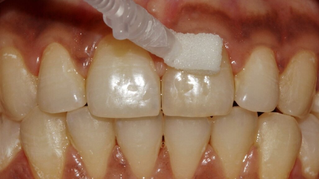 Curodont-Repair-Fluoride-Plus-Our-experience-has-been-extremely-positive_1