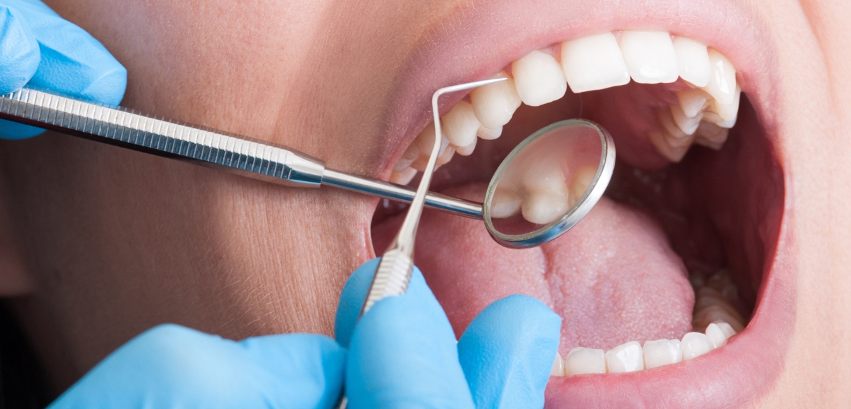 What-Are-the-Causes-of-Crumbling-Teeth