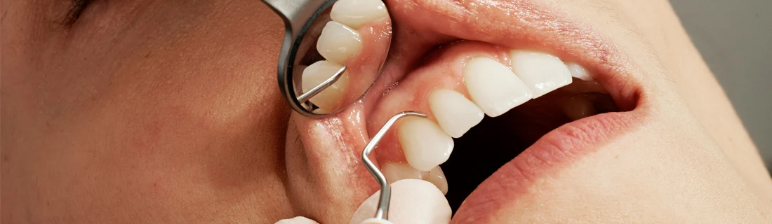 Dentist-Teeth-Cleaning-Focused