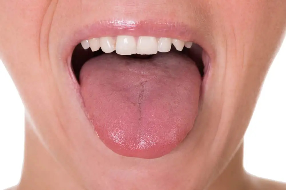 healthy-tongue-1 copy
