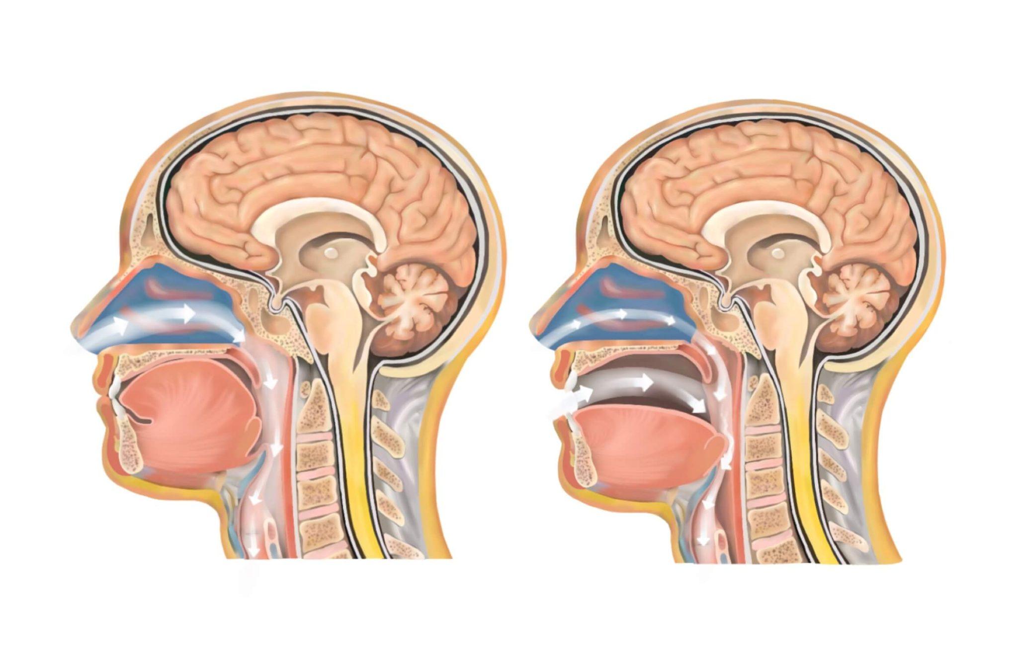 Nose vs Mouth