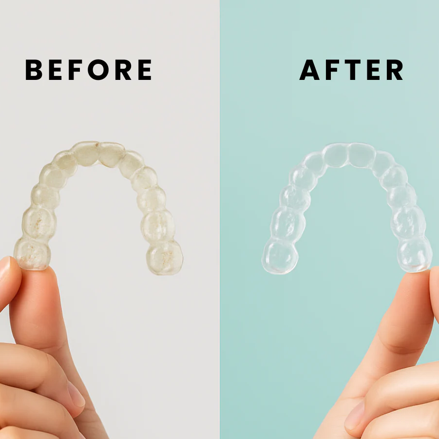 Results after five minutes with the Ultrasonic dental cleaner