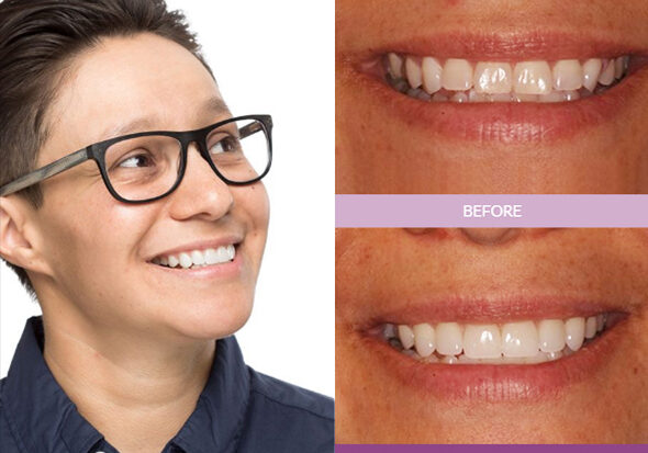 See more smile makeovers at Bright Star