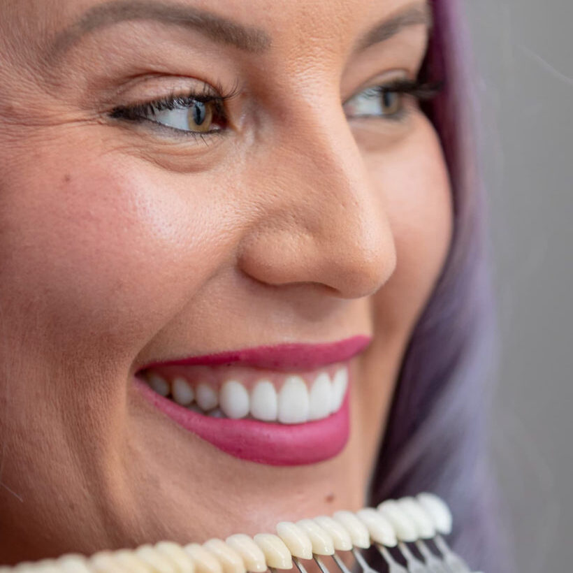 patient-with-Porcelain-Veneers-Las-Cruces-NM-820x1024